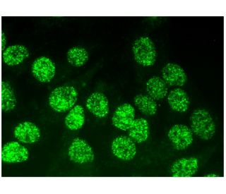 immunofluorescence image from recommended Rad52 (F-7) monoclonal antibody replacement. Image 293928