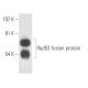 This polyclonal antibody has been discontinued. See our recommended <a href="rad53-antibody-a-9">Rad53 (A-9)</a> monoclonal antibody (sample data shown). western blotting image from recommended Rad53 (A-9) monoclonal antibody replacement. Image 15688
