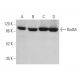 western blotting image from recommended Rad54 (F-11) monoclonal antibody replacement. Image 372841