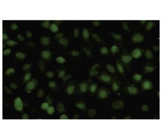 Rad54B Antibody (19-K2) - Immunofluorescence - Image 35861 