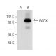 RADX Antibody (A-3) - Western Blotting - Image 324756