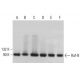 This polyclonal antibody has been discontinued. See our recommended <a href="raf-b-antibody-f-7">BRAF (F-7)</a> monoclonal antibody (sample data shown). western blotting image from recommended BRAF (F-7) monoclonal antibody replacement. Image 380225