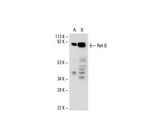 Raf-B Antibody (F-7) - Western Blotting - Image 7391