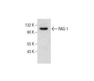 western blotting image from recommended RAG-1 (D-5) monoclonal antibody replacement. Image 281802