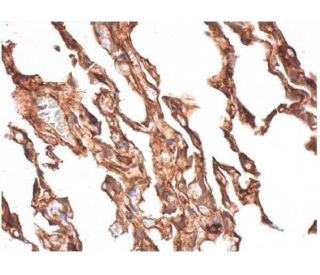確認用 RAGE Antibody (A-9) | SCBT - Santa Cruz Biotechnology
