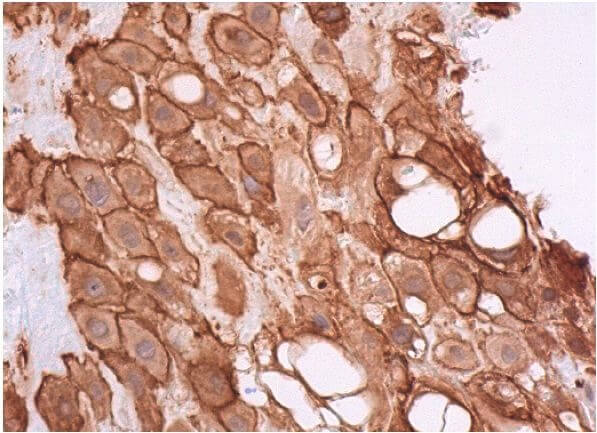 RAGE Antibody (A-9) | SCBT - Santa Cruz Biotechnology