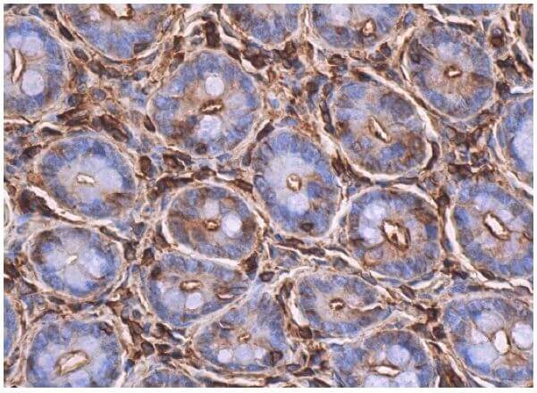 RAGE Antibody (A-9) | SCBT - Santa Cruz Biotechnology