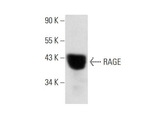 RAGE Antibody (A-9) | SCBT - Santa Cruz Biotechnology