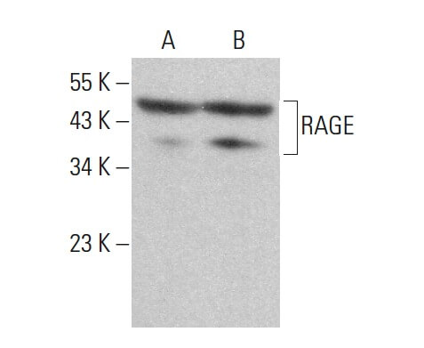 確認用 RAGE Antibody (A-9) | SCBT - Santa Cruz Biotechnology