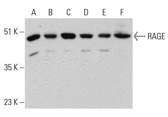 izkページ RAGE Antibody (A-9) | SCBT - Santa Cruz Biotechnology