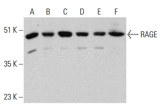 RAGE Antibody (A-9) | SCBT - Santa Cruz Biotechnology