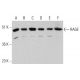 This polyclonal antibody has been discontinued. See our recommended <a href="rage-antibody-a-9">RAGE (A-9)</a> monoclonal antibody (sample data shown). western blotting image from recommended RAGE (A-9) monoclonal antibody replacement. Image 385727