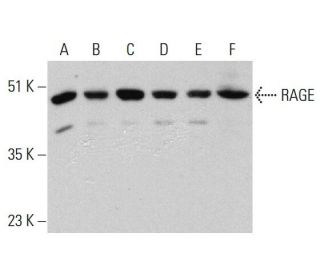 western blotting image from recommended RAGE (A-9) monoclonal antibody replacement. Image 385727