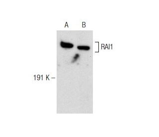 RAI1 Antibody (D-11) - Western Blotting - Image 142689 