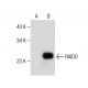 RAIDD Antibody (G-7) - Western Blotting - Image 281372