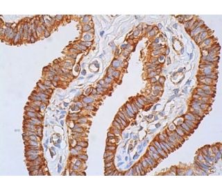 Rak Antibody (H-12) - Immunohistochemistry - Image 386556 