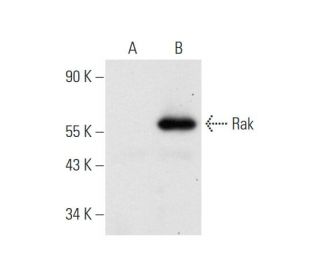 Rak Antibody (H-12) - Western Blotting - Image 81048Each CRISPR/Cas9 Knockout (KO) Plasmid product consists of a pool of 3 plasmids designed to ensure identification and cleavage of a specific gene for maximum knockout efficiency. Each plasmid encodes a unique 20 nt sequence derived from the GeCKO (v2) library.