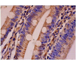 Ral A Antibody (F-5) - Immunohistochemistry - Image 286455 