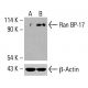 Ran BP-17 Antibody (B-1): sc-518249. Western blot analysis of Ran BP-17 expression in untreated (A) and chemically-treated (B) HCT-116 whole cell lysates. Detection reagent used: m-IgG<sub>1</sub> BP-HRP: sc-525408. β-Actin (C4): sc-47778 used as loading control. Detection reagent used: m-IgG Fc BP-HRP: sc-525409. Ran BP-17 Antibody (B-1) - Western Blotting - Image 416498