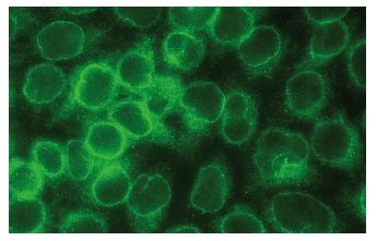 ran-bp-2-antibody-d-4-