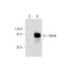 RANK Antibody (B-8) - Western Blotting - Image 288990 