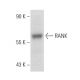 RANK Antibody (B-8) - Western Blotting - Image 389174