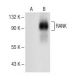 western blotting image from recommended RANK (H-7) monoclonal antibody replacement. Image 150173