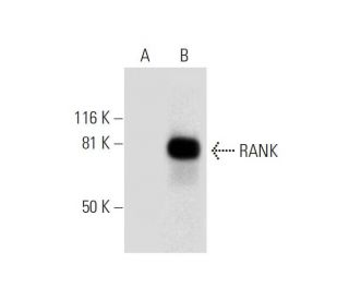 RANK Antibody (B-8) - Western Blotting - Image 288990