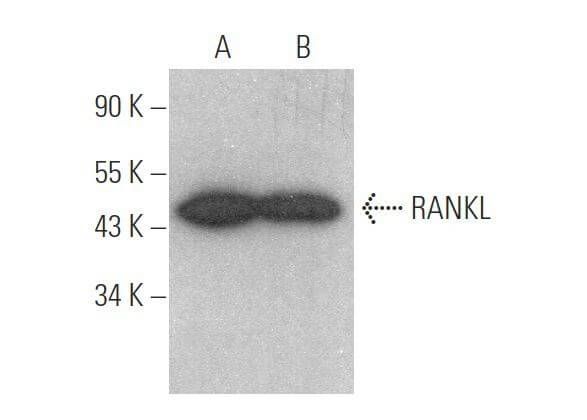 RANKL抗体(G-1) | SCBT - Santa Cruz Biotechnology