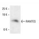 RANTES Antibody (A-4) - Western Blotting - Image 411776