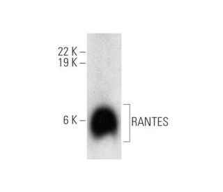 western blotting image from recommended RANTES (F-11) monoclonal antibody replacement. Image 314170