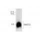 Este anticuerpo policlonal ha dejado de fabricarse. Consulta nuestro anticuerpo monoclonal recomendado <a href="rantes-antibody-f-11">RANTES (F-11)</a> (se muestran datos de muestra). western blotting image from recommended RANTES (F-11) monoclonal antibody replacement. Image 314170