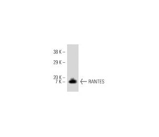 RANTES Antibody (VL1) - Western Blotting - Image 8927