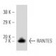 RANTES Antibody (VL1) - Western Blotting - Image 8927