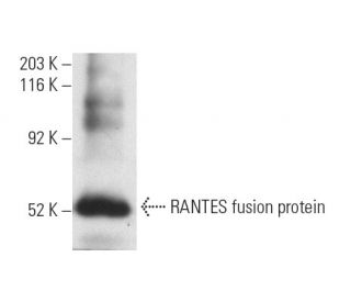 RANTES Antibody (VL2) - Western Blotting - Image 9892
