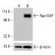 Rap1GAP-Antikörper (E-11): sc-390826. Western-Blot-Analyse der Rap1GAP-Expression in unbehandelten (A) und chemisch behandelten (B) K-562-Gesamtzelllysaten. β-Actin (C4): sc-47778 als Ladekontrolle verwendet. Verwendetes Nachweisreagenz: m-IgG Fc BP-HRP: sc-525409. Rap1GAP Antibody (E-11) - Western Blotting - Image 415161