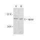 rapsyn Antibody (1234) - Western Blotting - Image 285217