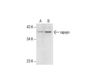 rapsyn Antibody (1234) - Western Blotting - Image 285957 