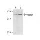 rapsyn Antibody (1234) - Western Blotting - Image 285957 