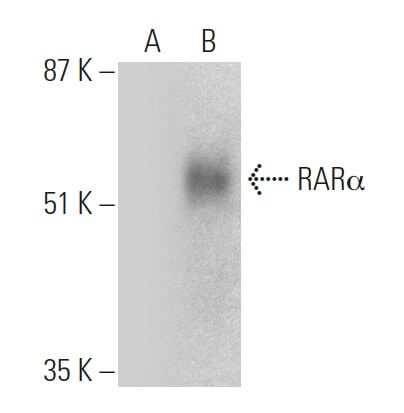 RARα/Retinoic Acid Receptor α Antibody (C-1) | SCBT - Santa Cruz ...