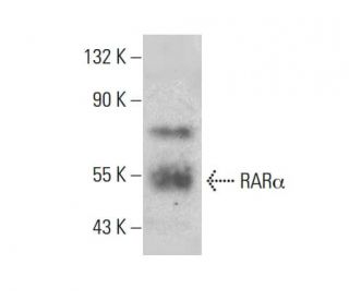 RARα/Retinoic Acid Receptor α Antibody (C-1) | SCBT - Santa Cruz ...