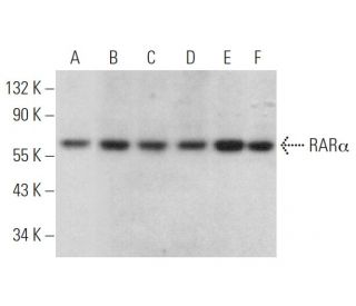western blotting image from recommended RAR&alpha;/Retinoic Acid Receptor &alpha; (C-1) monoclonal antibody replacement. Image 375889