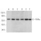 western blotting image from recommended RARα/Retinoic Acid Receptor α (C-1) monoclonal antibody replacement. Image 375889