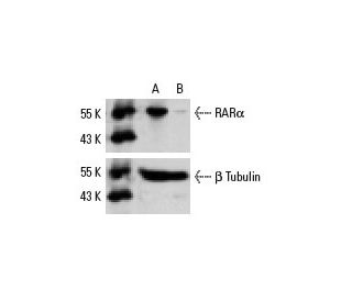 RAR&alpha; siRNA (h): sc-29465. Western blot analysis of RAR&alpha; expression in non-transfected control (A) and RAR&alph 