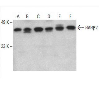 RARβ/Retinoic Acid Receptor β Antibody (B-12) - Western Blotting - Image 394076
