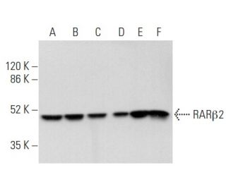 western blotting image from recommended RAR&beta;/Retinoic Acid Receptor &beta; (B-12) monoclonal antibody replacement. Image 354873