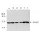 western blotting image from recommended RARβ/Retinoic Acid Receptor β (B-12) monoclonal antibody replacement. Image 354873