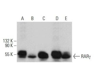 western blotting image from recommended RAR&gamma;/Retinoic Acid Receptor &gamma; (H-6) monoclonal antibody replacement. Image 376571