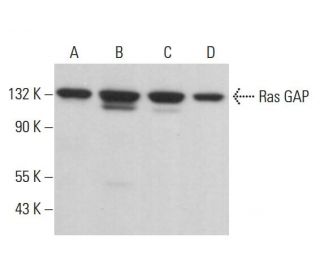 western blotting image from recommended Ras GAP (B4F8) monoclonal antibody replacement. Image 380867