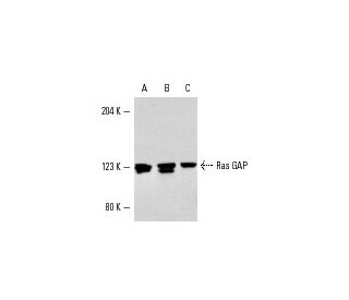 Ras GAP Antibody (D4B4) - Western Blotting - Image 4282